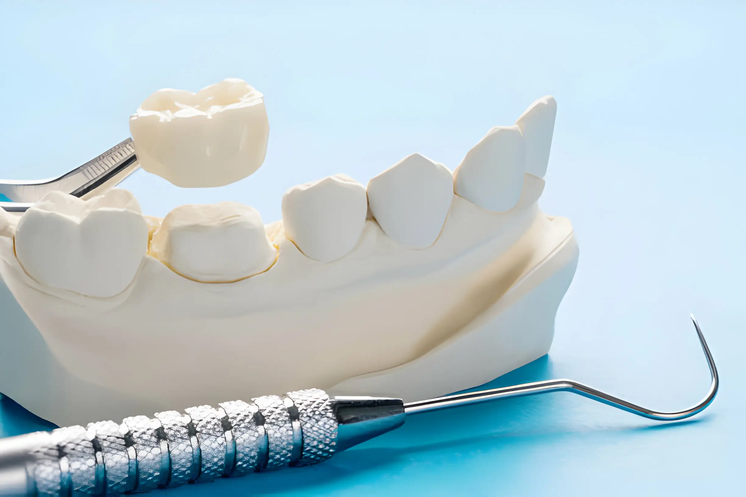 Fillings & Crowns