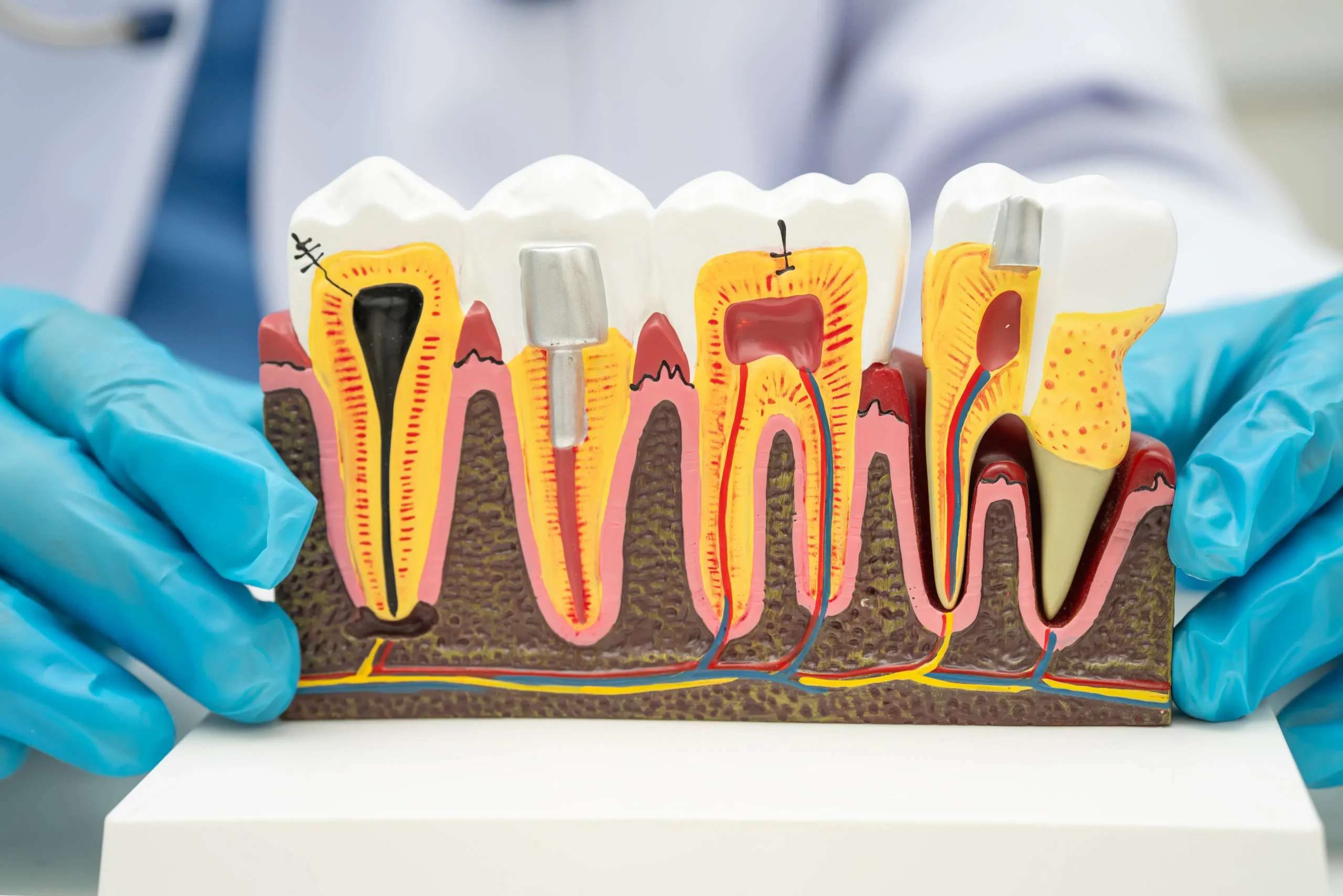 dentist-holding-dental-implant (1) dentist-holding-dental-implant