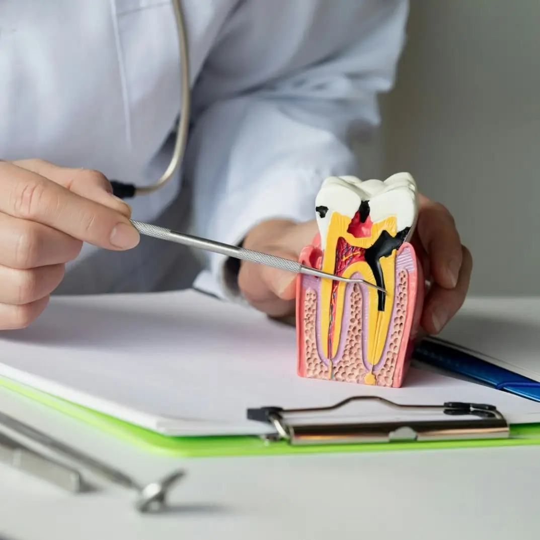 rootcanal-model